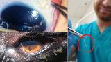V Česku se objevil oční červ: Kde je riziko největší? Epidemiolog vyjmenoval oblasti