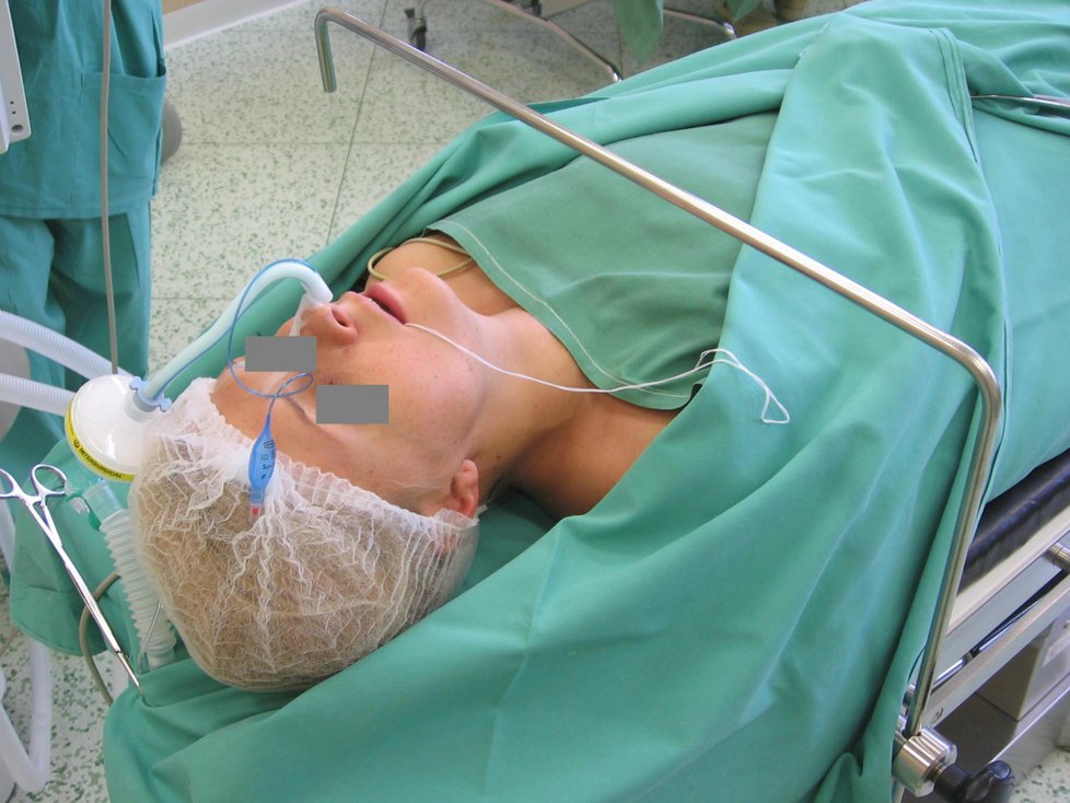 Po uspání pacienta se zavede dýchací rourka skrze nosní dutinu do úst a následovně do průdušnice.
