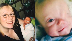 Chlapec s autismem se narodil bez oka!