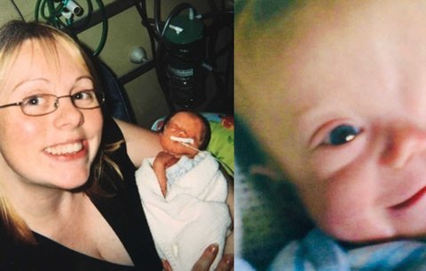 Chlapeček s autismem se narodil bez oka. Lékaři ale umí zázraky!