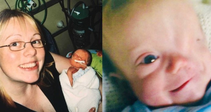 Chlapec s autismem se narodil bez oka!