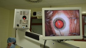 To co oční specialistka Klára Marešová viděla v okuláru mikroskopu se zobrazovalo i na monitoru v operačním sále