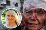Fotka zkrvavené učitelky obletěla svět: Olena podstoupila operaci a brzy znovu uvidí