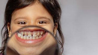 Co prozradí zuby o zdraví dítěte? Zaměřte se na tohle Co prozradí zuby o zdraví dítěte? Zaměřte se na tohle