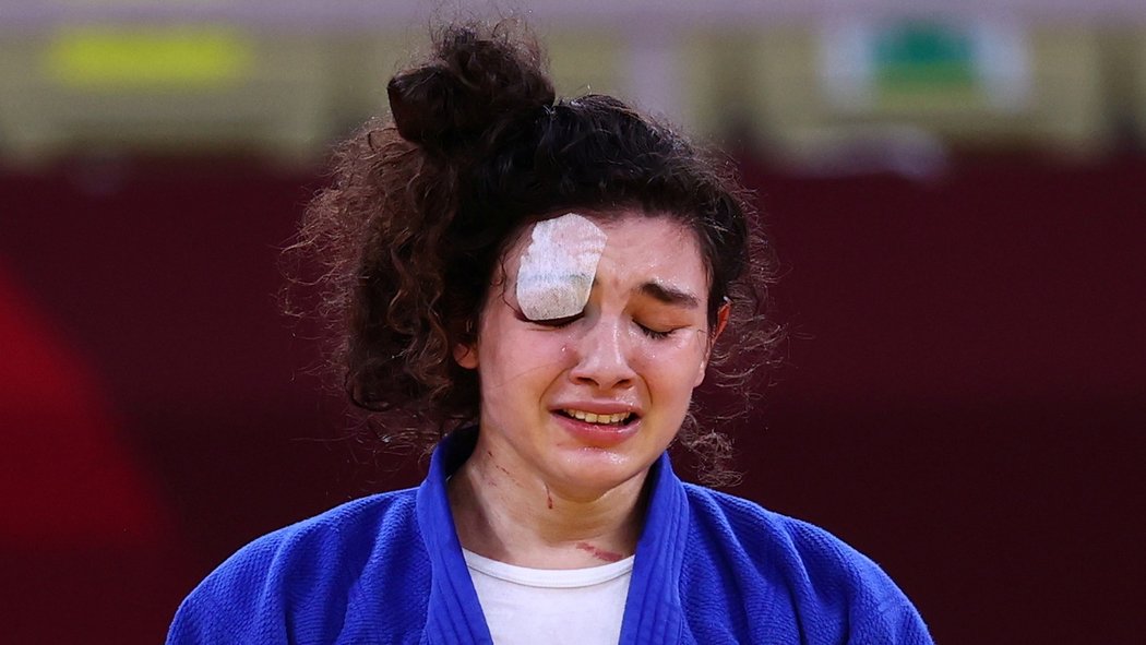Ruská judistka Madinoa Tajmazovová dokráčela k bronzu v kategorii do 70 kg s vážně zraněným okem