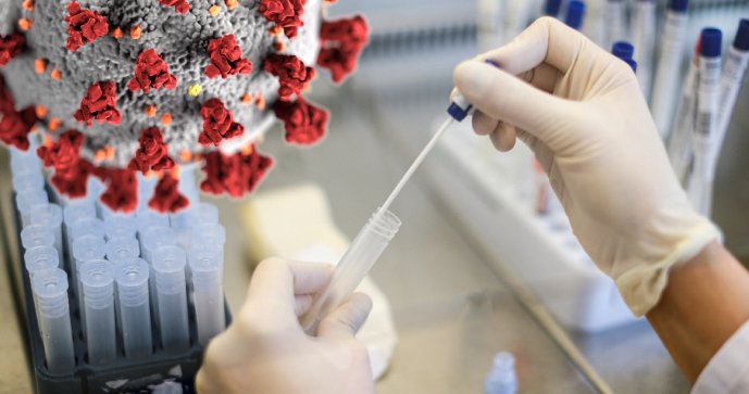 Podle výrobce PCR testů Diana Biotechnologies bude na konci ledna denně 200 tisíc případů omikronu v Česku.