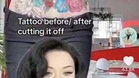 Kráska z Only Fans ukazuje na sítích dopady plastické operace: Nechala si odstranit velké tetování přímo na břiše!