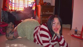 Modelka z OnlyFans málem oslepla.