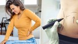 Lékaři prozradili: Toto jsou nejbolestivější operace