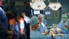 Unikátní operace u sv. Anny v Brně: Lékaři ženě vyměnili obě kolena najednou