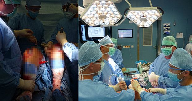 Unikátní operace u sv. Anny v Brně: Lékaři ženě vyměnili obě kolena najednou