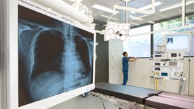Čeští lékaři provedli unikátní operaci, ale museli pacientovi odstranit jednu plíci (ilustrační foto).