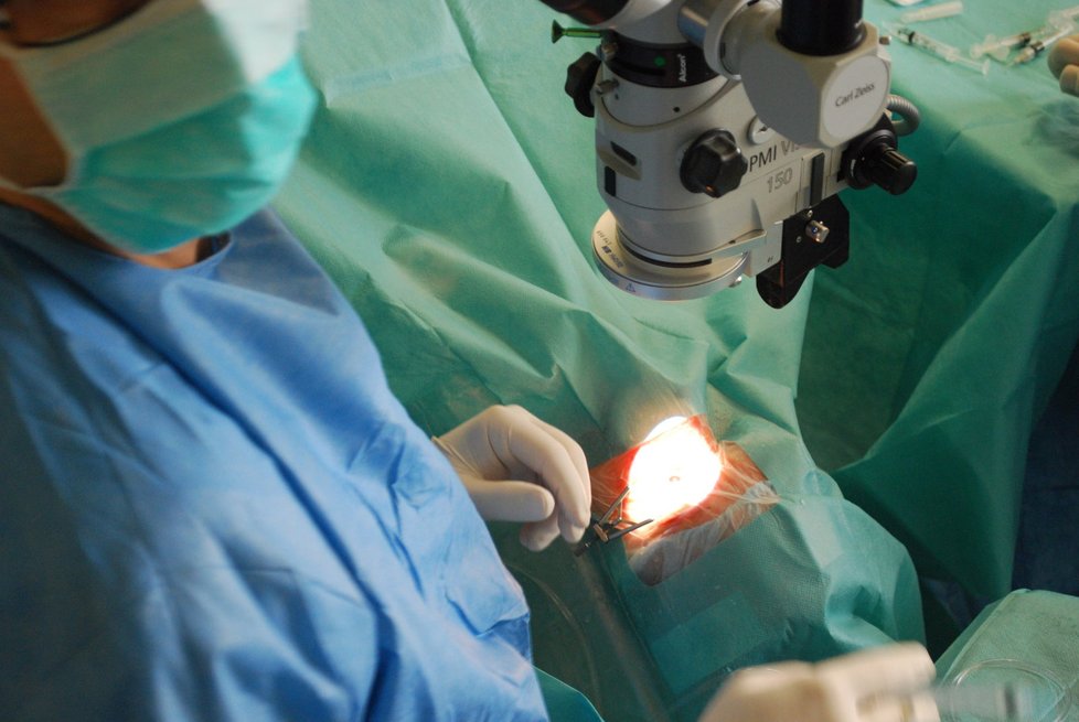 Záběr na oko pacienta v průběhu operace