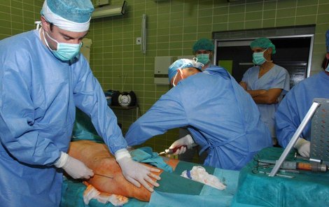 Lékaři odebírají z boků pacientky tuk, který se později použije jako výplň rekonstruovaného ňadra.