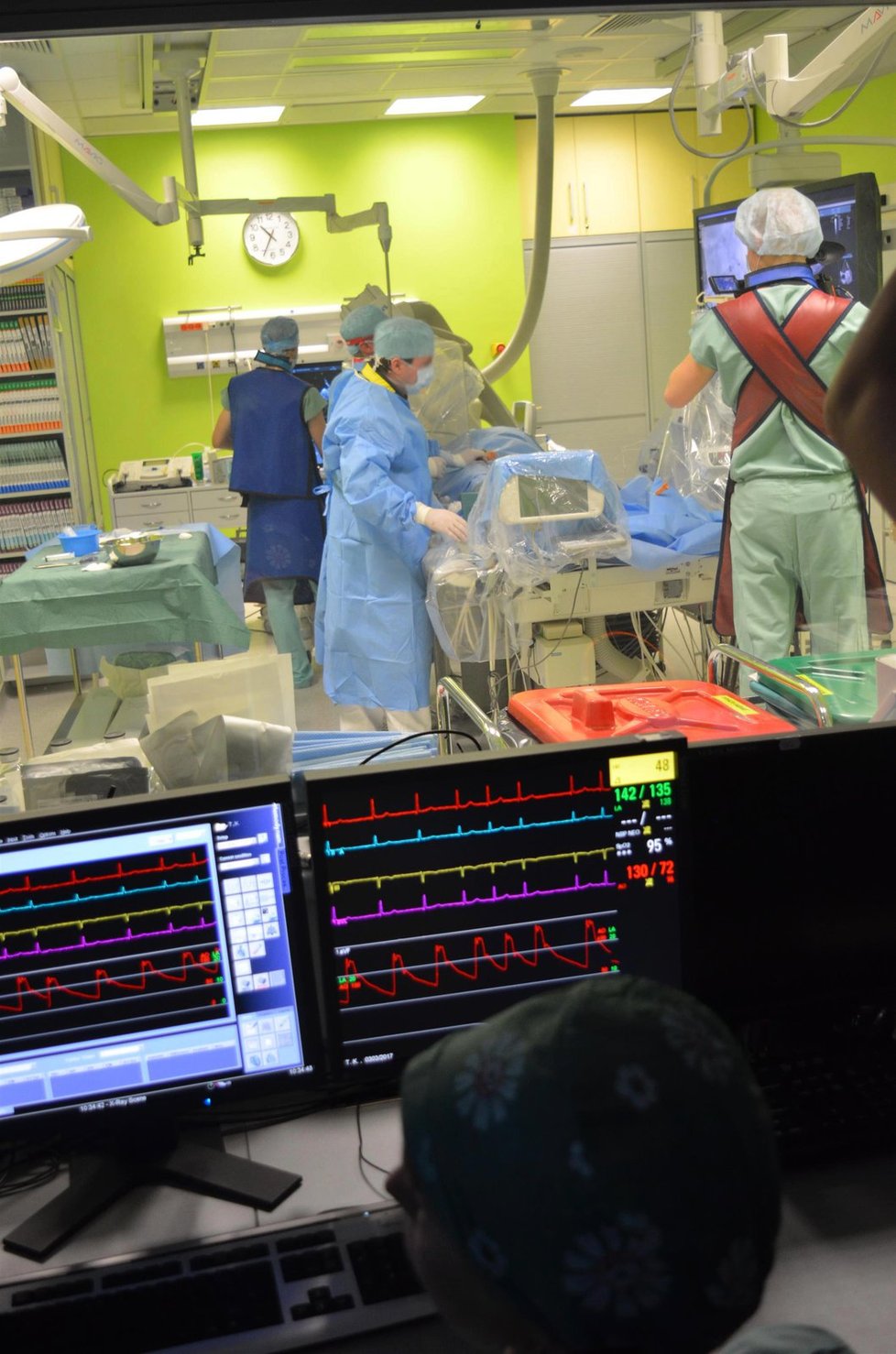 Tým MUDr. Petra Kaly použil nový ultrazvukový přístroj s mimořádně přesným zobrazením pacientova těla i samotného zákroku.