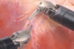 Dvě až tři ramena chirurgické konzole jsou nástrojová a jedno kamerové. Jejich zakončení přesně kopírují pohyb ruky.