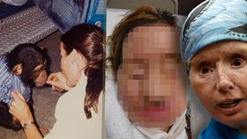 Milovaný šimpanz v záchvatu brutálně napadl ženu: Roztrhal jí obličej a snědl oči