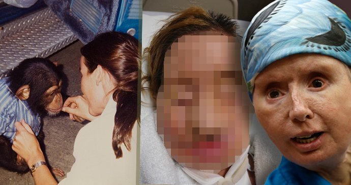 Milovaný šimpanz v záchvatu brutálně napadl ženu: Roztrhal jí obličej a snědl oči
