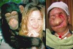 Před útokem šimpanze byla Charla pěkná žena, útok opice jí změnil život...