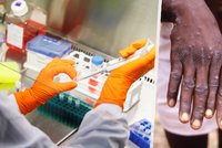 Vakcína proti pravým neštovicím může fungovat proti opičím. Do Česka dorazí první várka