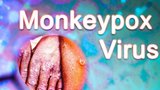 V první fázi je to jako viróza, říká praktik o opičích neštovicích. Jaká vakcína a léky na ně fungují?