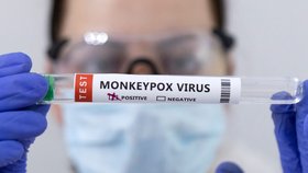 Opičí neštovice se prokazují metodou PCR.