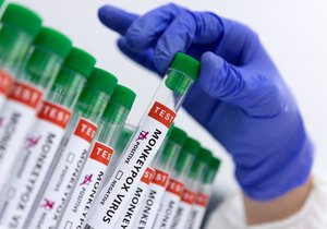 Opičí neštovice se prokazují metodou PCR.