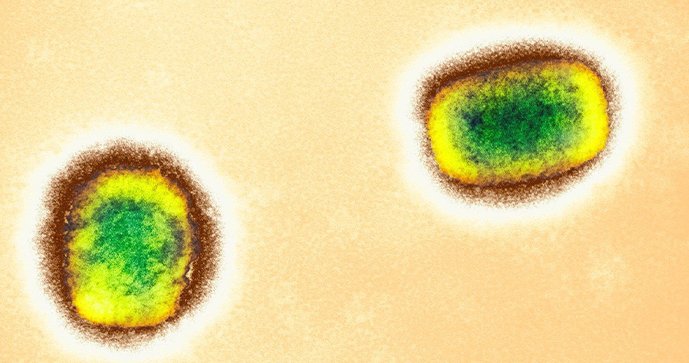 Virus opičích neštovic