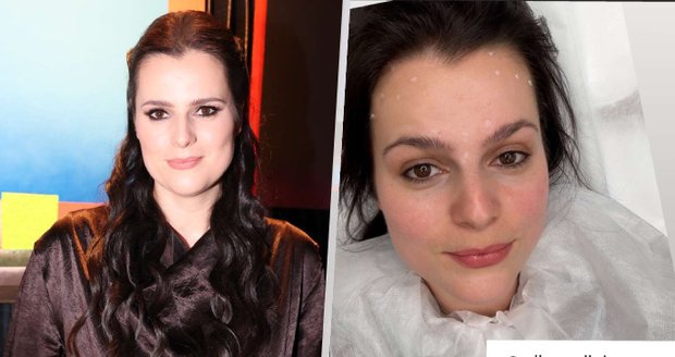 Ornella si zašla na botox.