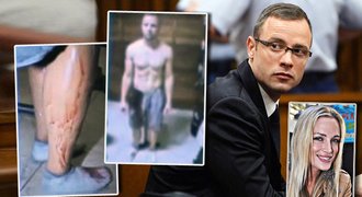 Fotky Pistoriuse poté, co zastřelil přítelkyni: Polonahý, otřesený a celý od krve!