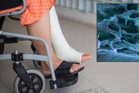 Tichý zloděj kostí pacienty předem nevaruje: Lékaři nabízí lepší prevenci proti osteoporóze