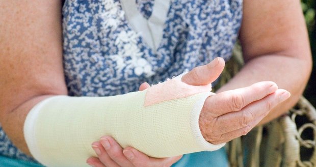 Na nemoc se typicky přijde až při tzv. osteoporotické zlomenině.