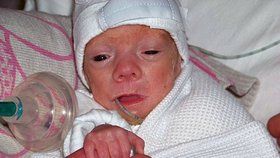 Toto je další drobeček, kterému po narození asi moc lidí nevěřilo. Sidney je jedním z nejmenších dětí, které tak nízkou porodní váhu přežily. Když se narodil, vážil pouhých 425 gramů. Lékaři mu nedávali velkou šanci. Své mamince se vešel do dlaně.