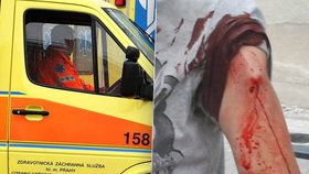 Žena na Českolipsku umírala týdny s otevřenou zlomeninou: Kamarád se bál poplatku za sanitku