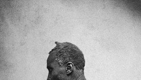 Zbičovaný otrok, Louisiana, 1863.