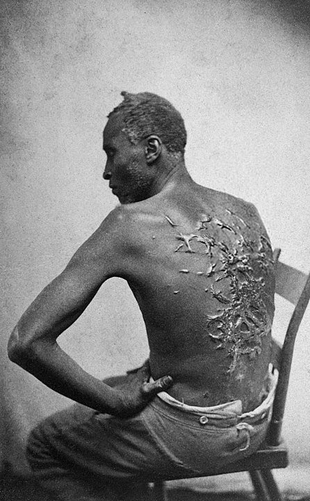 Zbičovaný otrok, Louisiana, 1863.