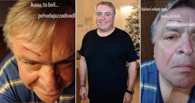 Herec Otto Rošetzký se zranil při vaření