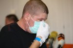Pacient Lukáš Musil po unikátní transplantaci jater po otravě léky na horečku