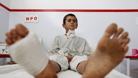 Pacienti, kteří přežili bombardování NATO, se léčí většinou v Kábulu. Převažují mezi nimi děti.