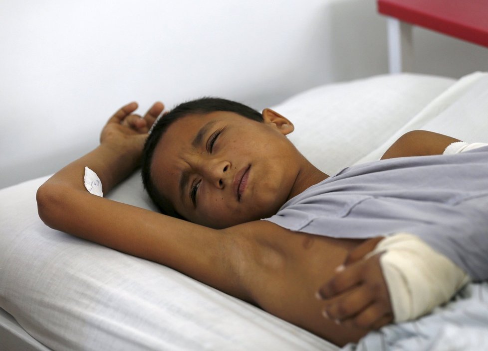 Pacienti, kteří přežili bombardování NATO, se léčí většinou v Kábulu. Převažují mezi nimi děti.