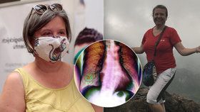 Lékařka Areta (54) nekouřila, přesto má rakovinu plic: Uvědomila jsem si blízkost smrti