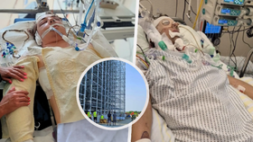 Oliver (19) a Martin (23) bojují o život: Na brigádě spadli z 12 patra!