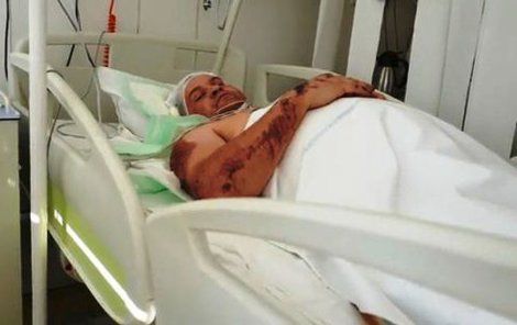 Brňan leží v popradské nemocnici, kde ho čeká další zákrok.