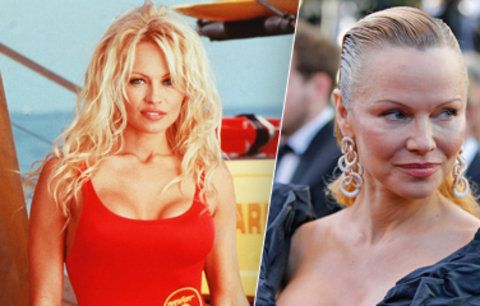 Šokující foto silikonové kočky z Pobřežní hlídky: Takhle se změnila Pamela Anderson!