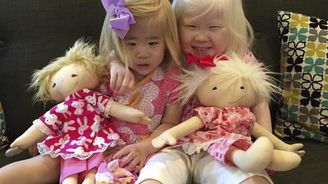 Američanka šije panenky pro postižené děti. Jsou přesně jako ony: krásné a jedinečné