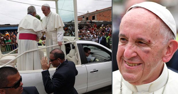 Papež František má monokl a roztržené obočí: V papamobilu se uhodil o sloupek