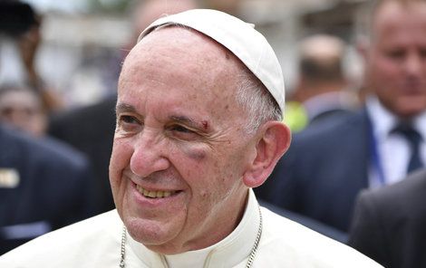 Papež se bouchl o sloupek v papamobilu a takhle to dopadlo.