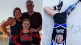 Holčička (11) přišla v dětství o nohu: Stala se ale fantastickou roztleskávačkou a chce na paralympiádu