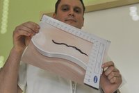 Nový parazit v Česku: V močovém měchýři ženy byl 10centimetrový červ