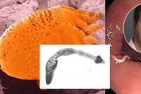 Tihle parazité žijí v našem těle! Odhalit je někdy může být problém, přiznává odborník!